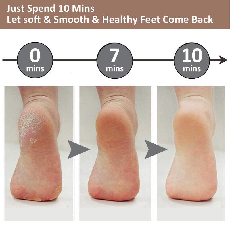 Rechargeable Electric Foot Callus Remover, Electric Foot Callus Remover Kit Foot File, Cordless Pedicure Machine, Foot Grinder, Portable Foot Files Cleaning Tool for Home and Travel,